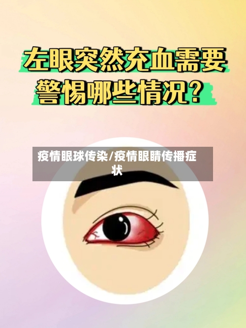 疫情眼球传染/疫情眼睛传播症状-第1张图片