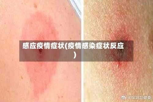 感应疫情症状(疫情感染症状反应)