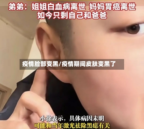 疫情脸部变黑/疫情期间皮肤变黑了
