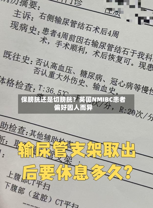 保膀胱还是切膀胱？英国NMIBC患者偏好因人而异