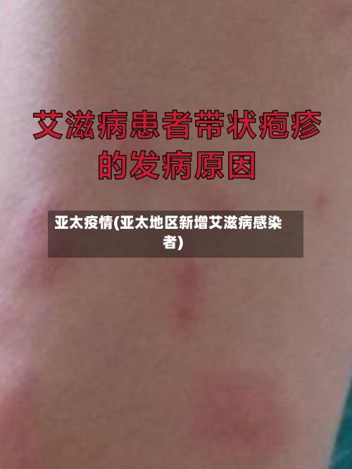 亚太疫情(亚太地区新增艾滋病感染者)