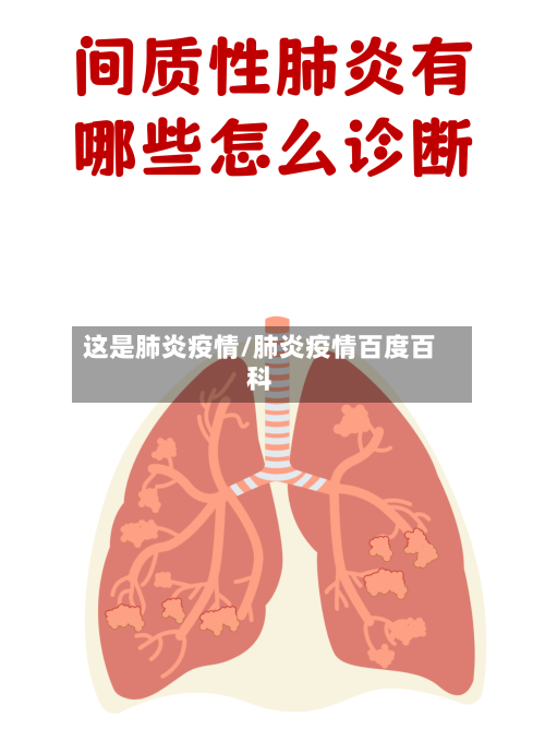这是肺炎疫情/肺炎疫情百度百科