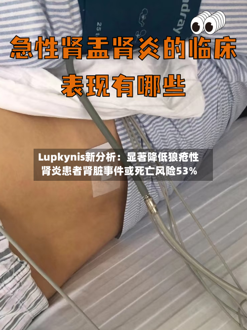 Lupkynis新分析：显著降低狼疮性肾炎患者肾脏事件或死亡风险53%
