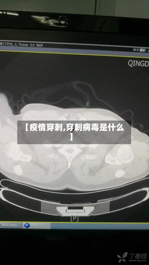 【疫情穿刺,穿刺病毒是什么】