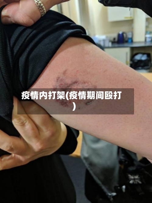疫情内打架(疫情期间殴打)