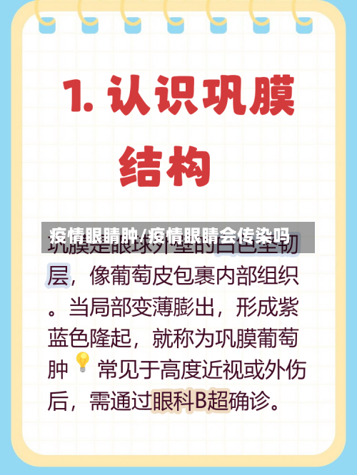 疫情眼睛肿/疫情眼睛会传染吗