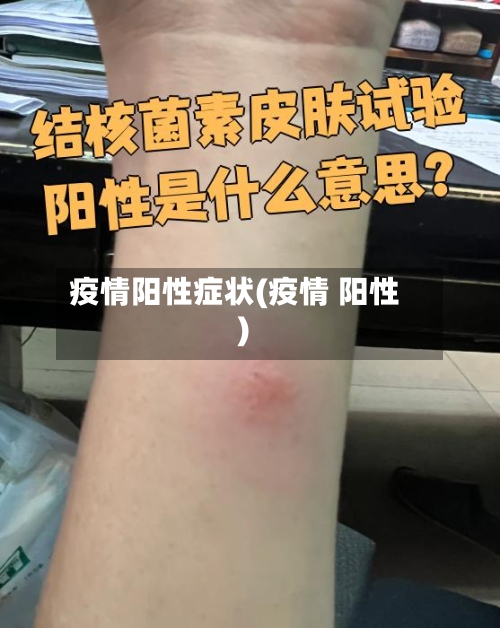 疫情阳性症状(疫情 阳性)
