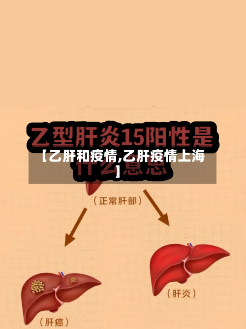 【乙肝和疫情,乙肝疫情上海】