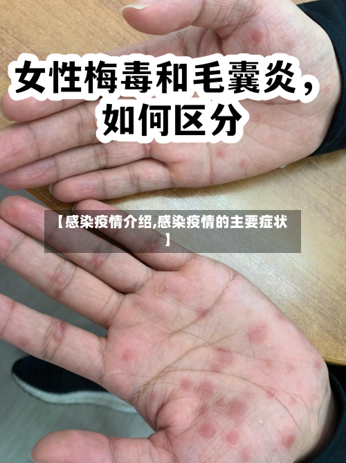 【感染疫情介绍,感染疫情的主要症状】